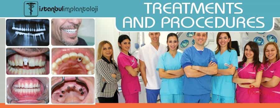 Dental Treatments and Procedures in Istanbul, Turkey